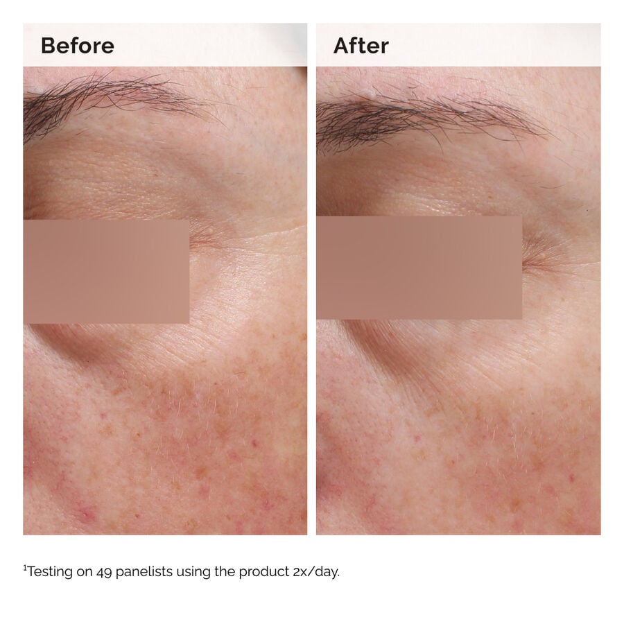 niacinamide-5-face-and-body-emulsion-b0 2024-08-23-ORD-Nia-5pct-Face-Body-B-A-Elasticity-Global-02-1x1.jpg