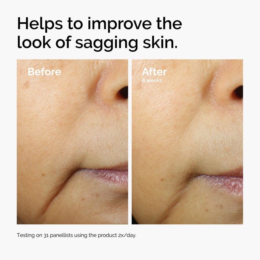 caffeine-3-escin-1-face-serum-g2 ord-caffeine-3pct-escin-1pct-face-serum-before-after-sagging.jpg