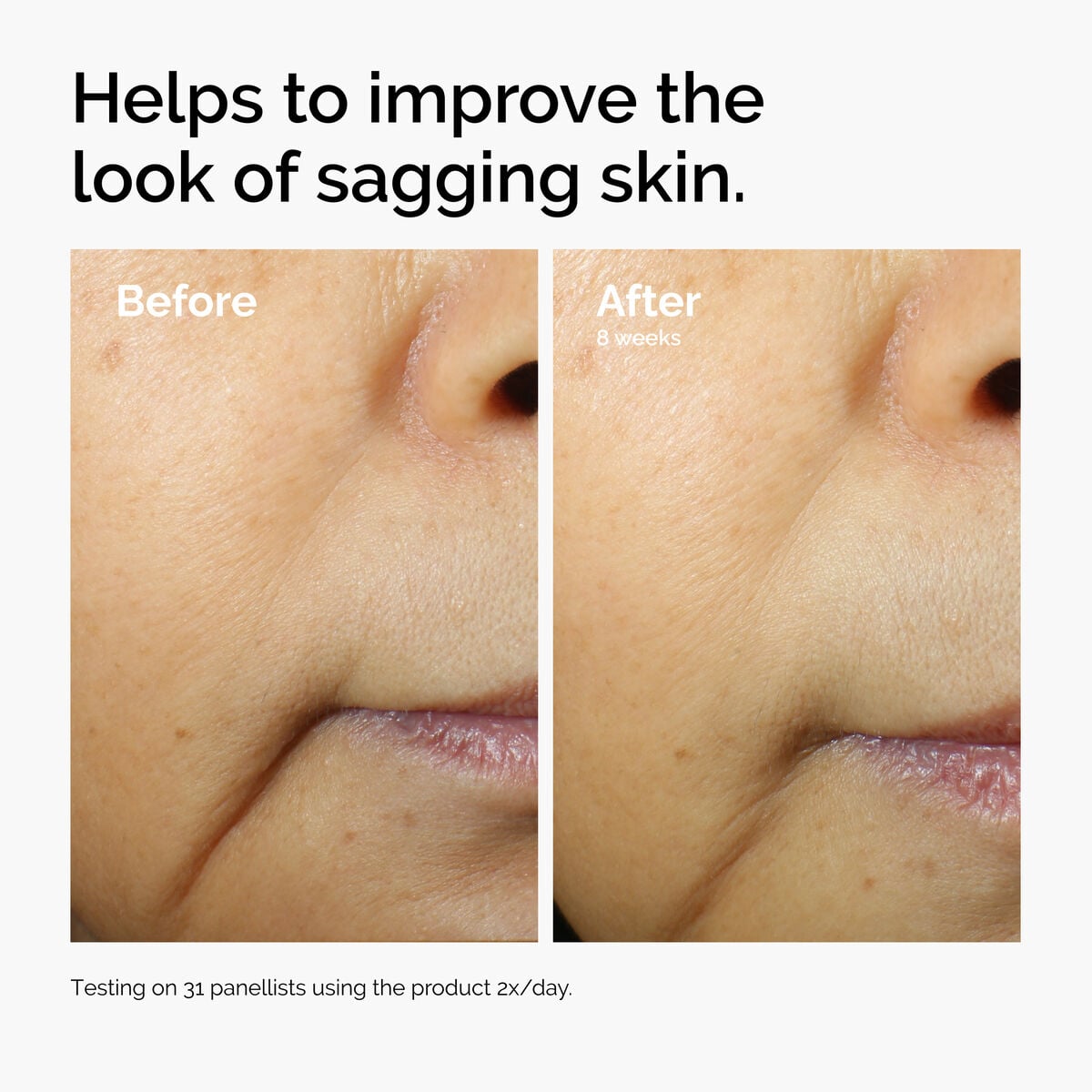 caffeine-3-escin-1-face-serum-g2 ord-caffeine-3pct-escin-1pct-face-serum-before-after-sagging.jpg
