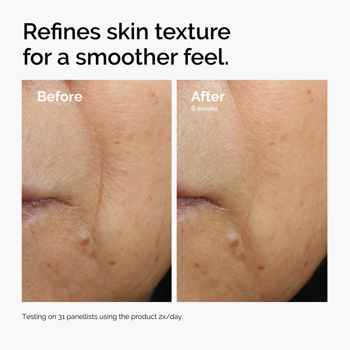 caffeine-3-escin-1-face-serum-g2 ord-caffeine-3pct-escin-1pct-face-serum-before-after-texture.jpg