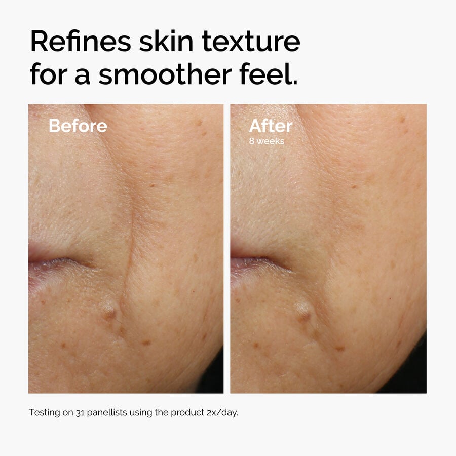 caffeine-3-escin-1-face-serum-g2 ord-caffeine-3pct-escin-1pct-face-serum-before-after-texture.jpg