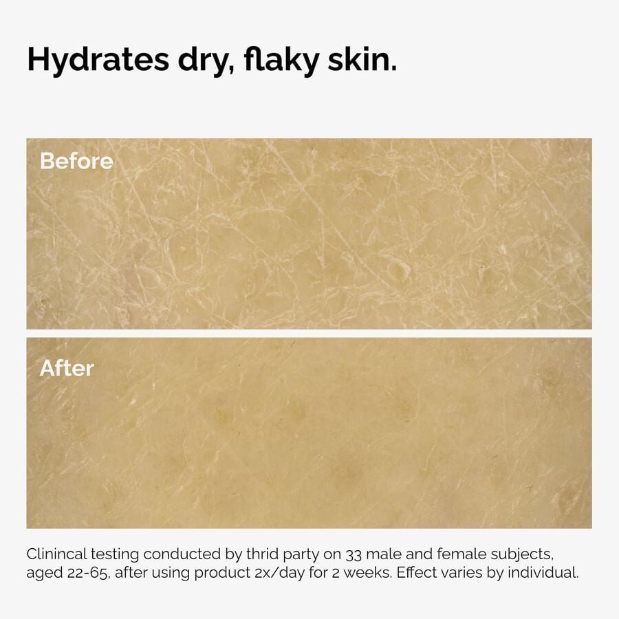 the-body-care-collection-o9 ord-natural-moisturizing-factors-inulin-body-before-after-graphic-02.jpg