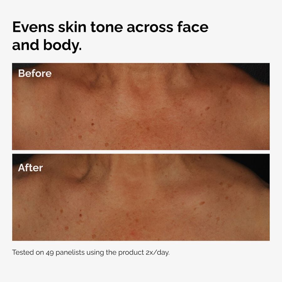 the-body-care-collection-o9 ord-niacinamide-face-body-serum-before-after-even-tone-graphic.jpg