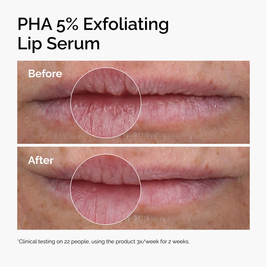 pha-5-exfoliating-lip-serum-i8 ord-pha-5pct-lip-exfoliating-serum-before-after.jpg