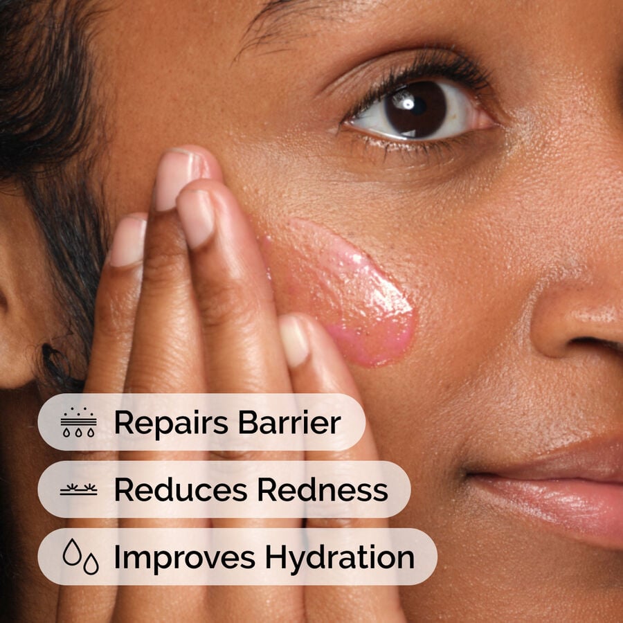 soothing-and-barrier-support-serum-y7 ord-soothing-barrier-support-serum-model-application-with-benefits.jpg